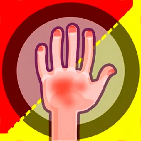 Two cartoon hands facing each other ready to slap